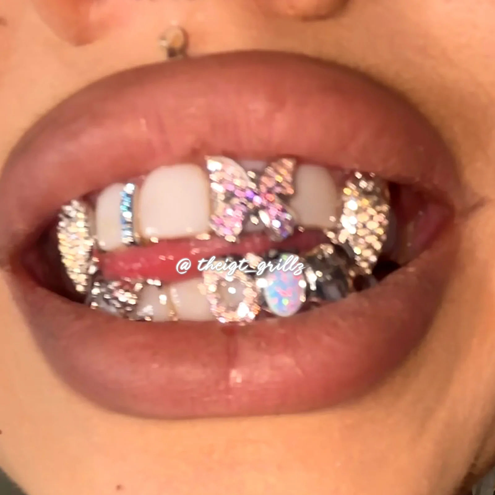 Thumbnail 11